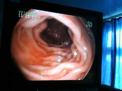 camera inside throat amateur male sex