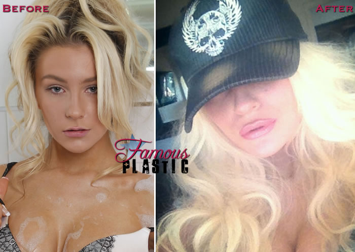 courtney stodden shows off swollen lip injections on twitter
