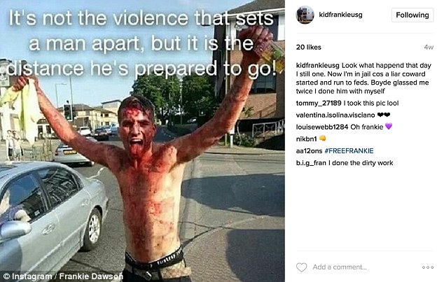 dawson uploaded this photo to instagram showing him bloodied in the streets with a caption