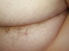 Hairy Asshole And Meaty Pussy 1