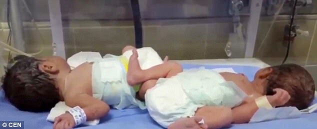 mexican woman gives birth to twins after having ivf daily
