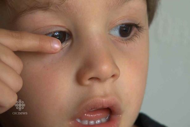 mother of three year old quebec boy goign public after receptionist glued her sons eye shut