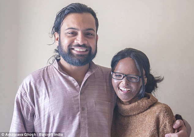 true love laxmi was left disfigured after suffering a brutal acid attack